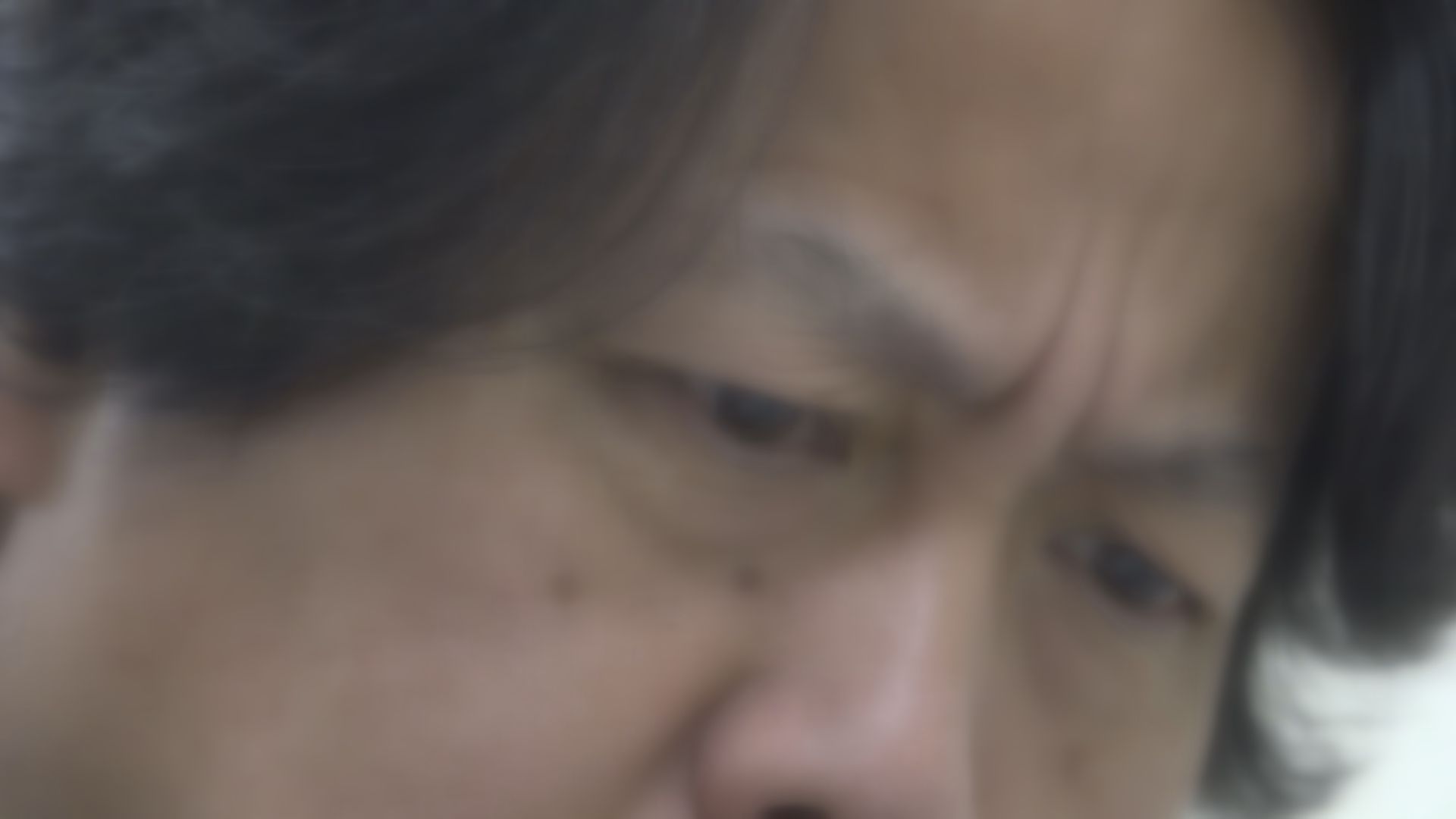 急激に進行する場合も