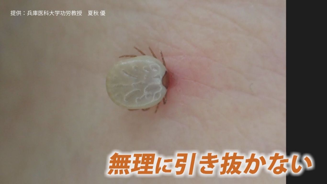 提供：兵庫医科大学功労教授　夏秋 優
