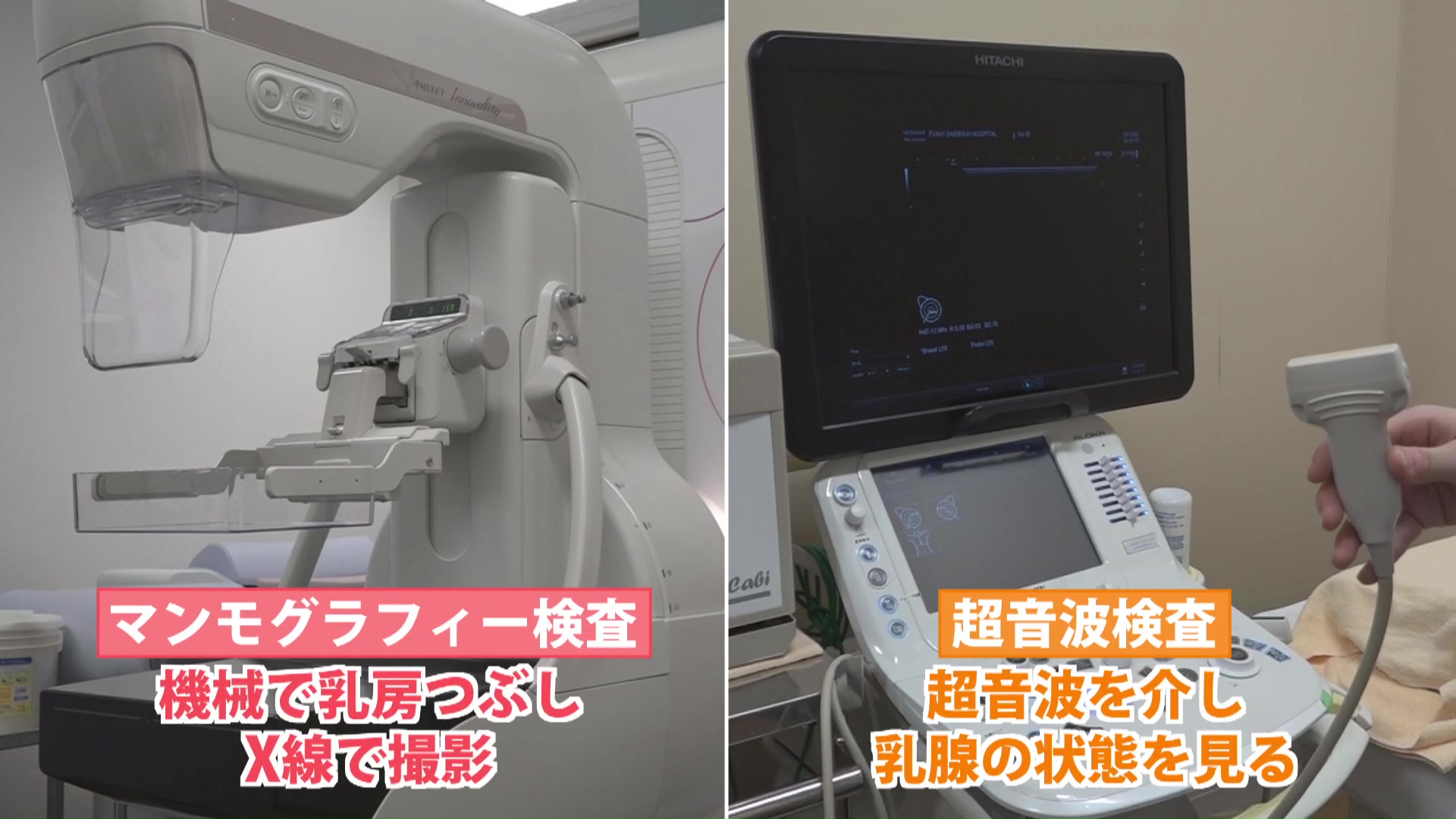 乳がん検査にはマンモグラフィや超音波が